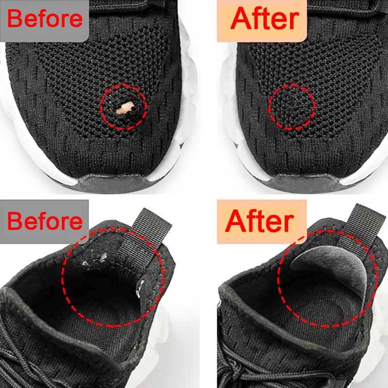 Sports Shoes Patches Vamp Repa - مراجعة Sports Equipment Repair وسعره